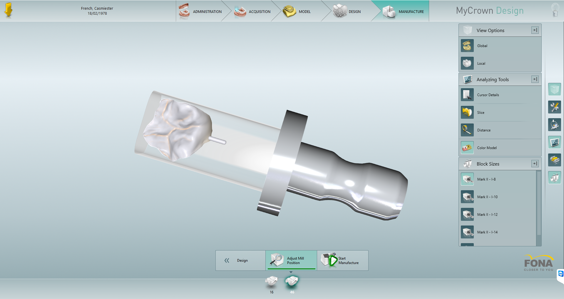 DT News - MEA - Removal of leaking amalgam restorations and placement ...