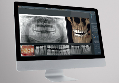 xray dentsply sirona