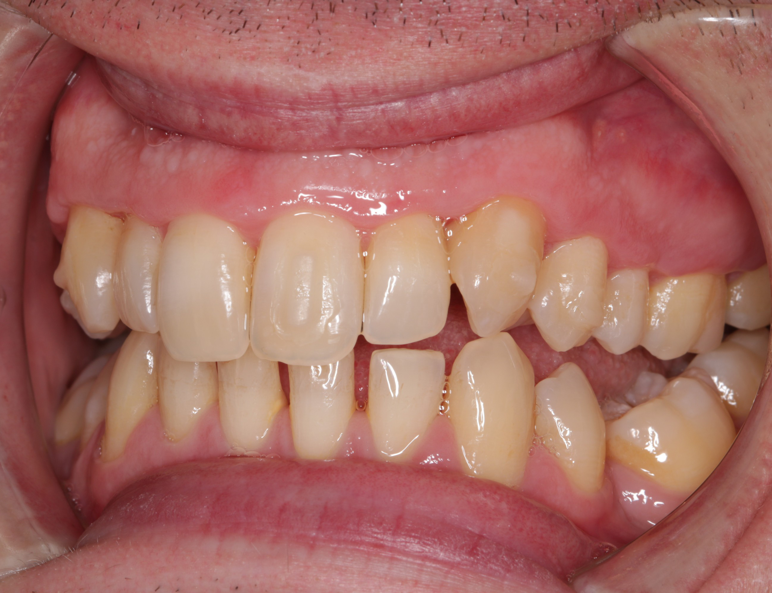 Dental News Getting to grips with general dental practitioner orthodontics