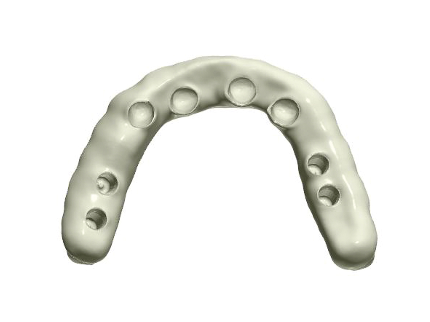 Dental News - The use of CBCT and CAD/CAM techniques in implant ...