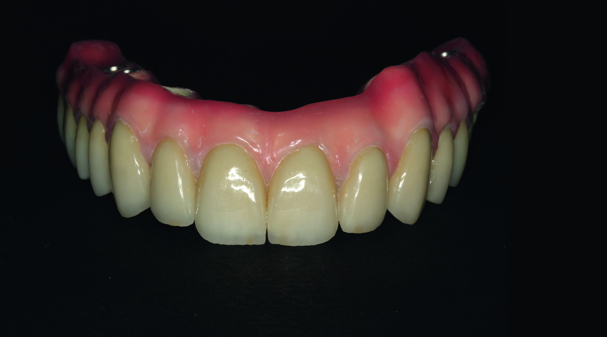 Dental News - The use of CBCT and CAD/CAM techniques in implant ...