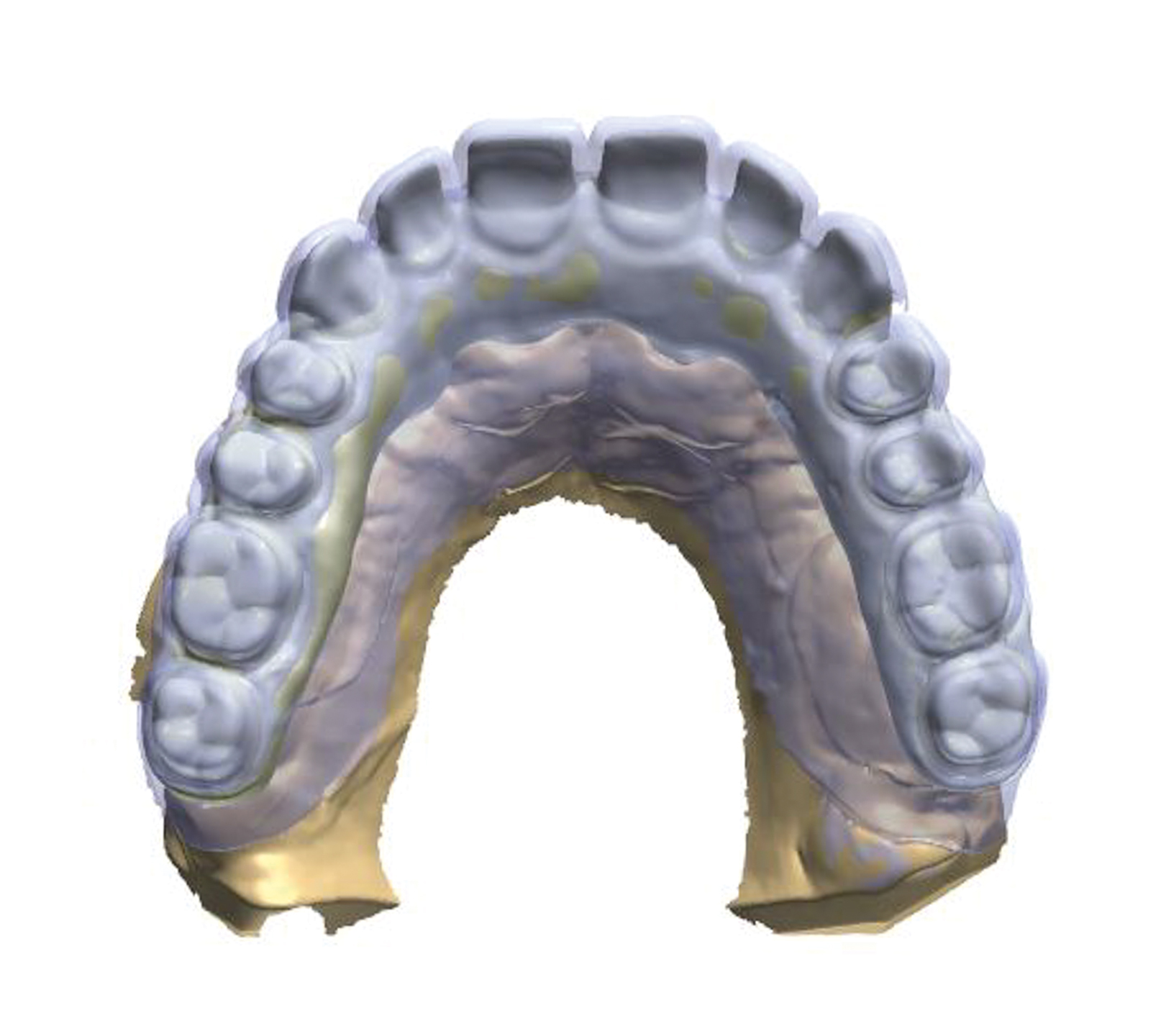 Dental News - The use of CBCT and CAD/CAM techniques in implant ...