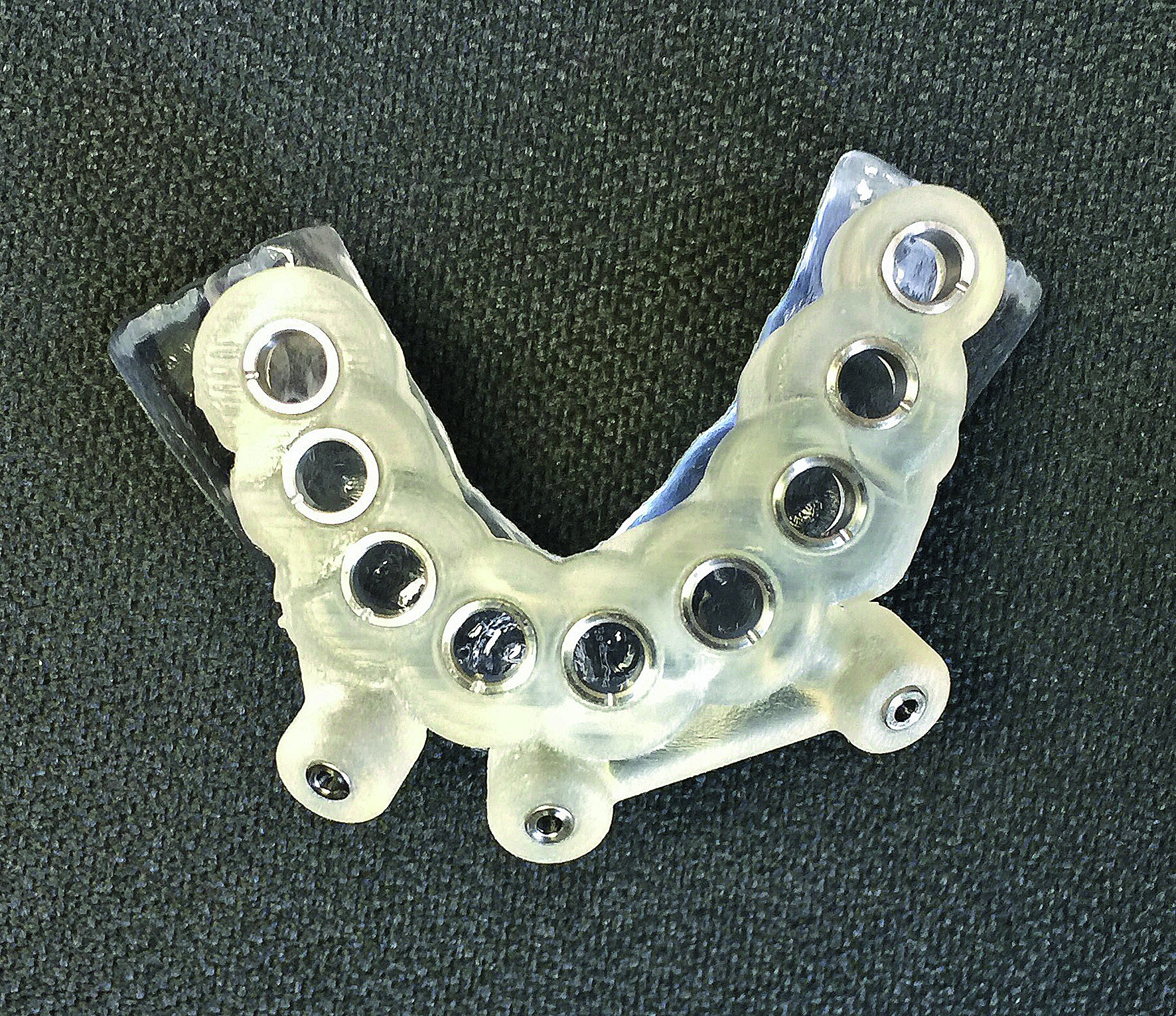 Dental News - Incorporating CAD/CAM solutions for full-mouth dental ...