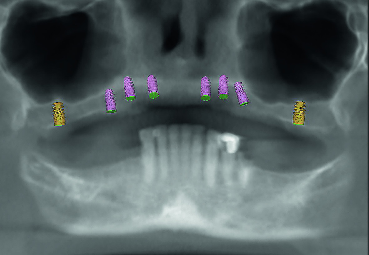 DT News - International - Incorporating CAD/CAM solutions for full ...