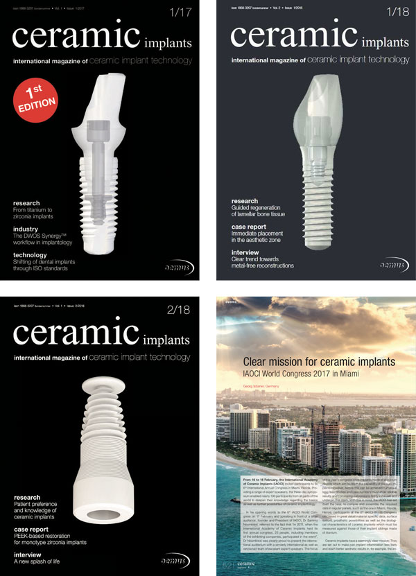 ceramic implants international Annual Subscription
