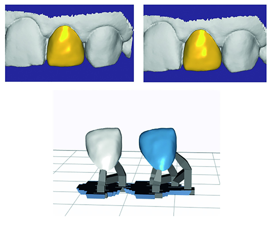 Dental News Optical impression and provisional prosthesis Proposal
