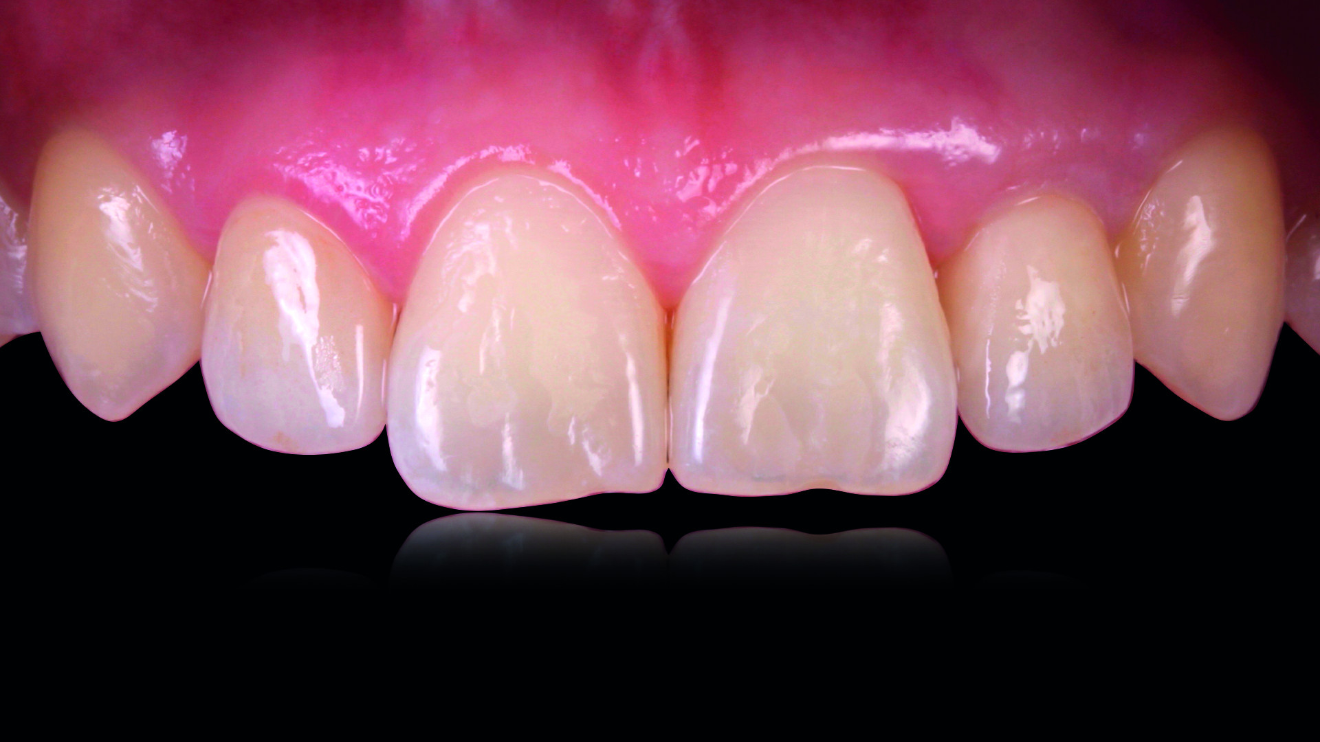 Dental News - The Complete Digital Implant Workflow