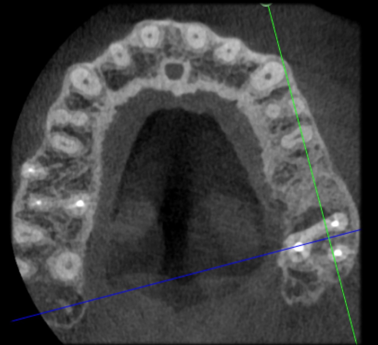 Dental News - Use of 3D technology in the diagnosis and treatment of ...