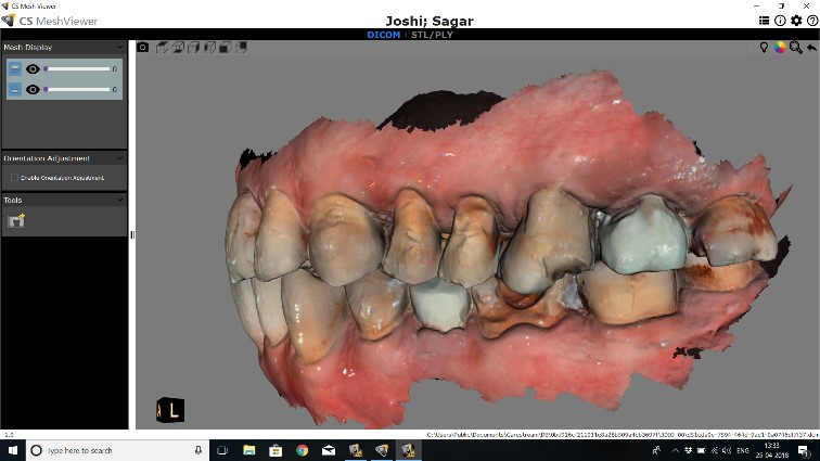 Knife-edges are back, thanks to adhesive tech & better understanding of ...