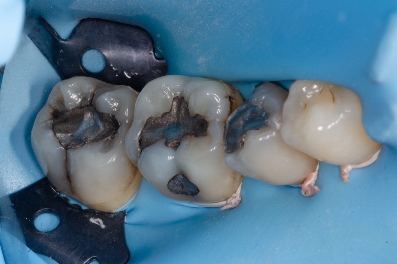 Dental News Daily aesthetic dentistry The contribution of the