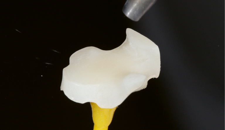 DT News - MEA - Easy and efficient: Composite resin blocks for the CAD ...