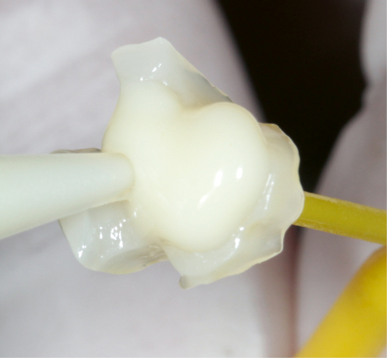 DT News - MEA - Easy and efficient: Composite resin blocks for the CAD ...