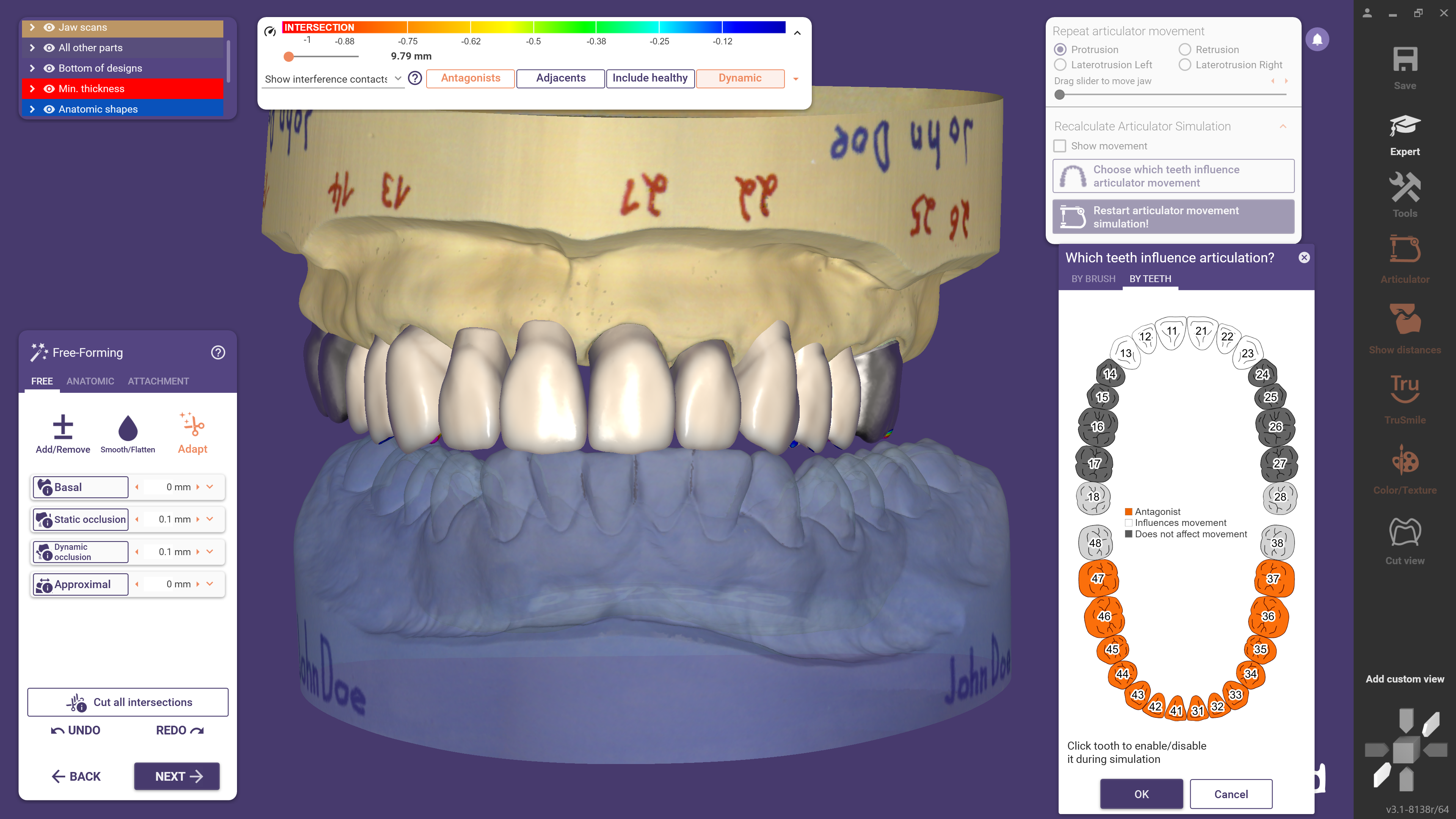 The Virtual Articulator can be opened directly in free-form mode in DentalCAD 3.1 Rijeka. (Image: exocad)