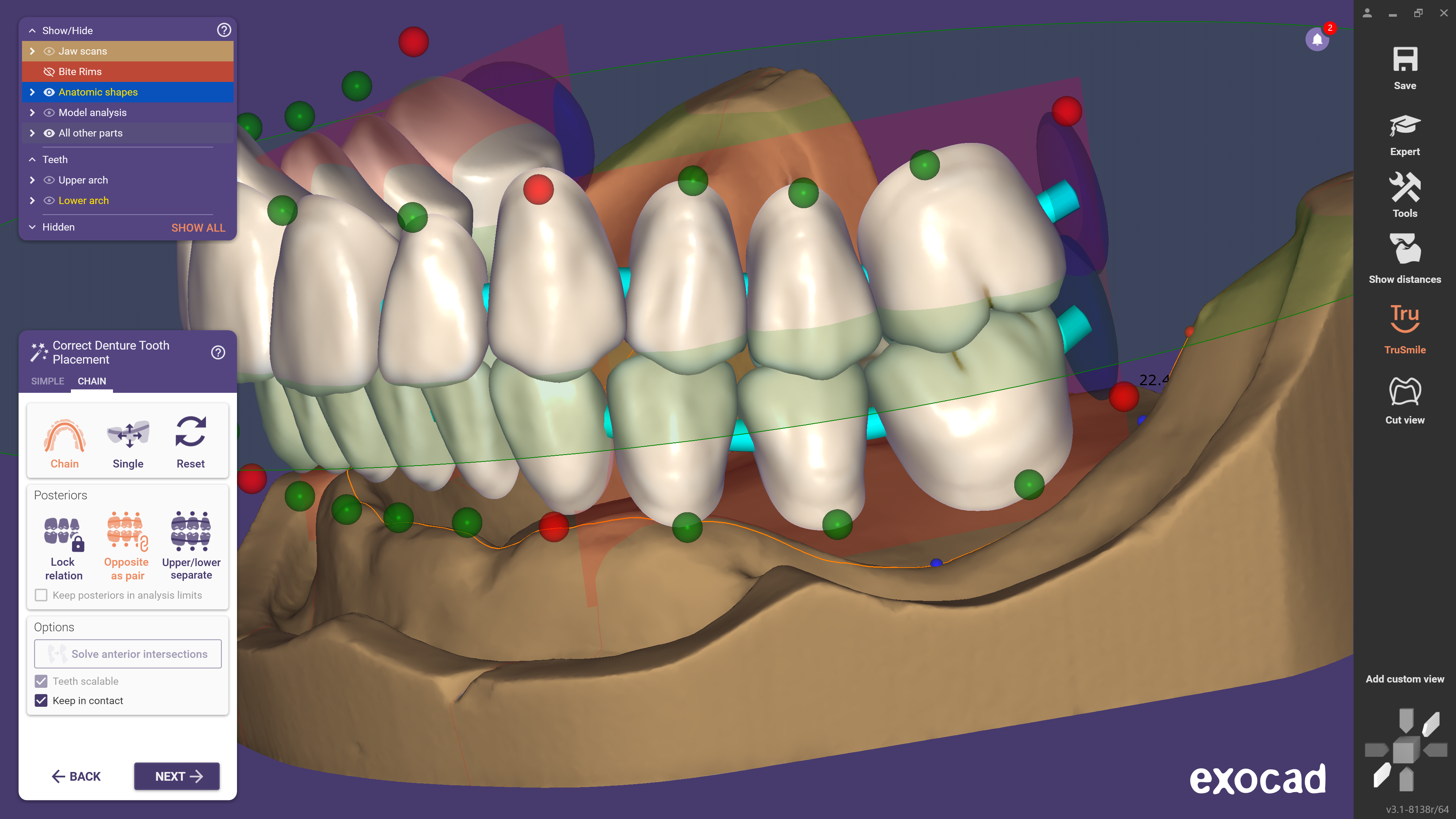 Posterior teeth can now also be individually adjusted in the set-up of full dentures. (Image: exocad)