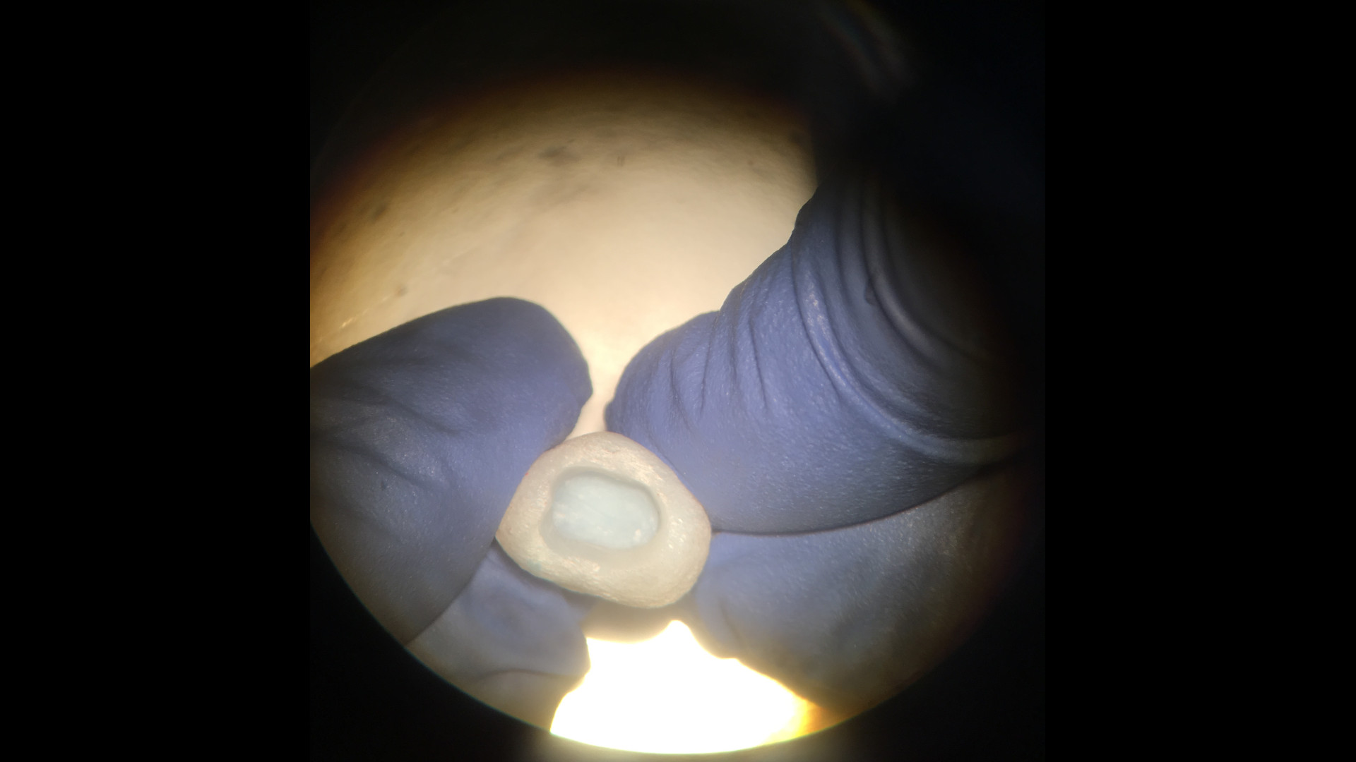 A 3D printed molar as viewed by a student under a clinical microscope.
