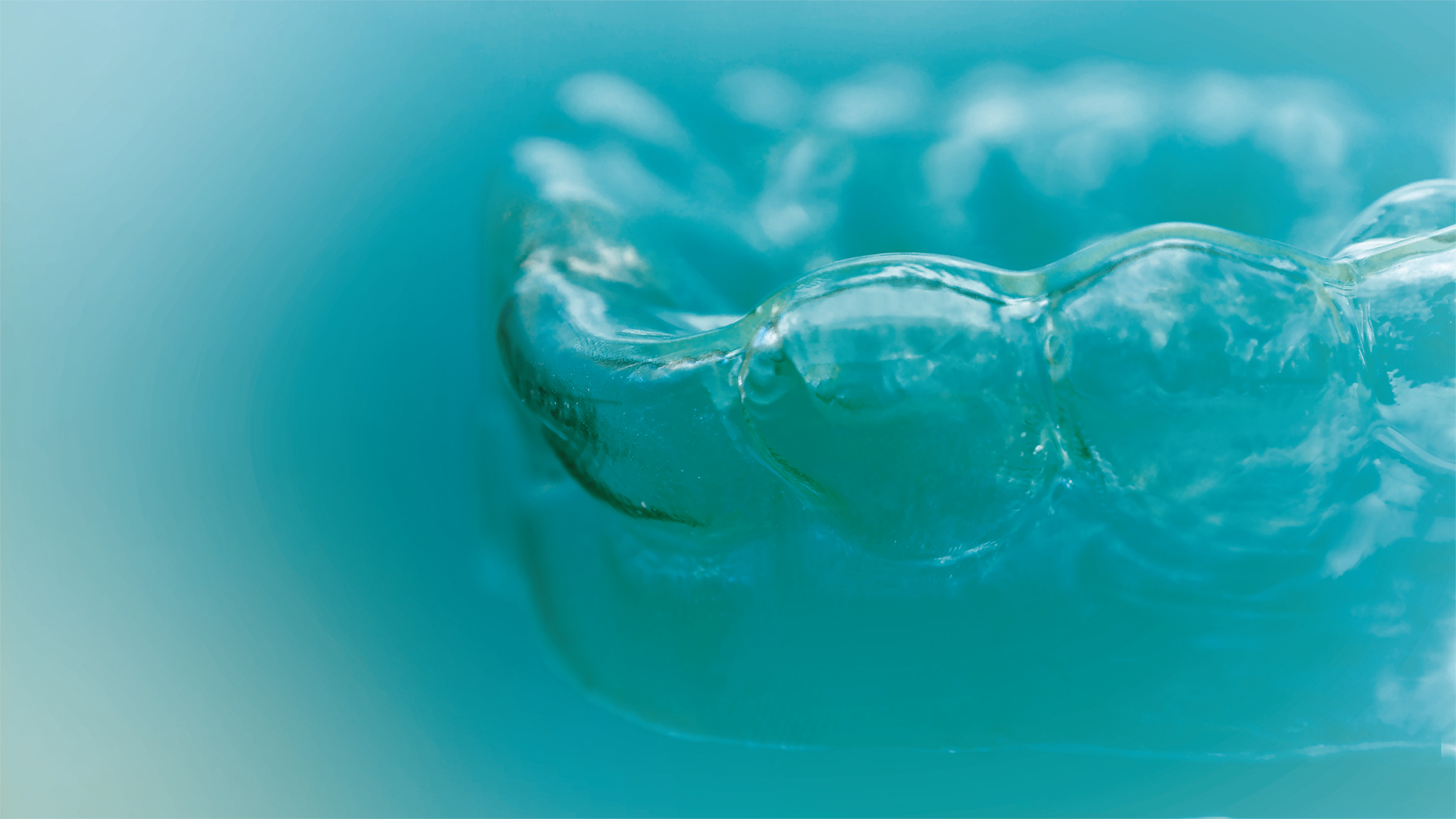 Dental News - Fraunhofer using smart materials to make clear 