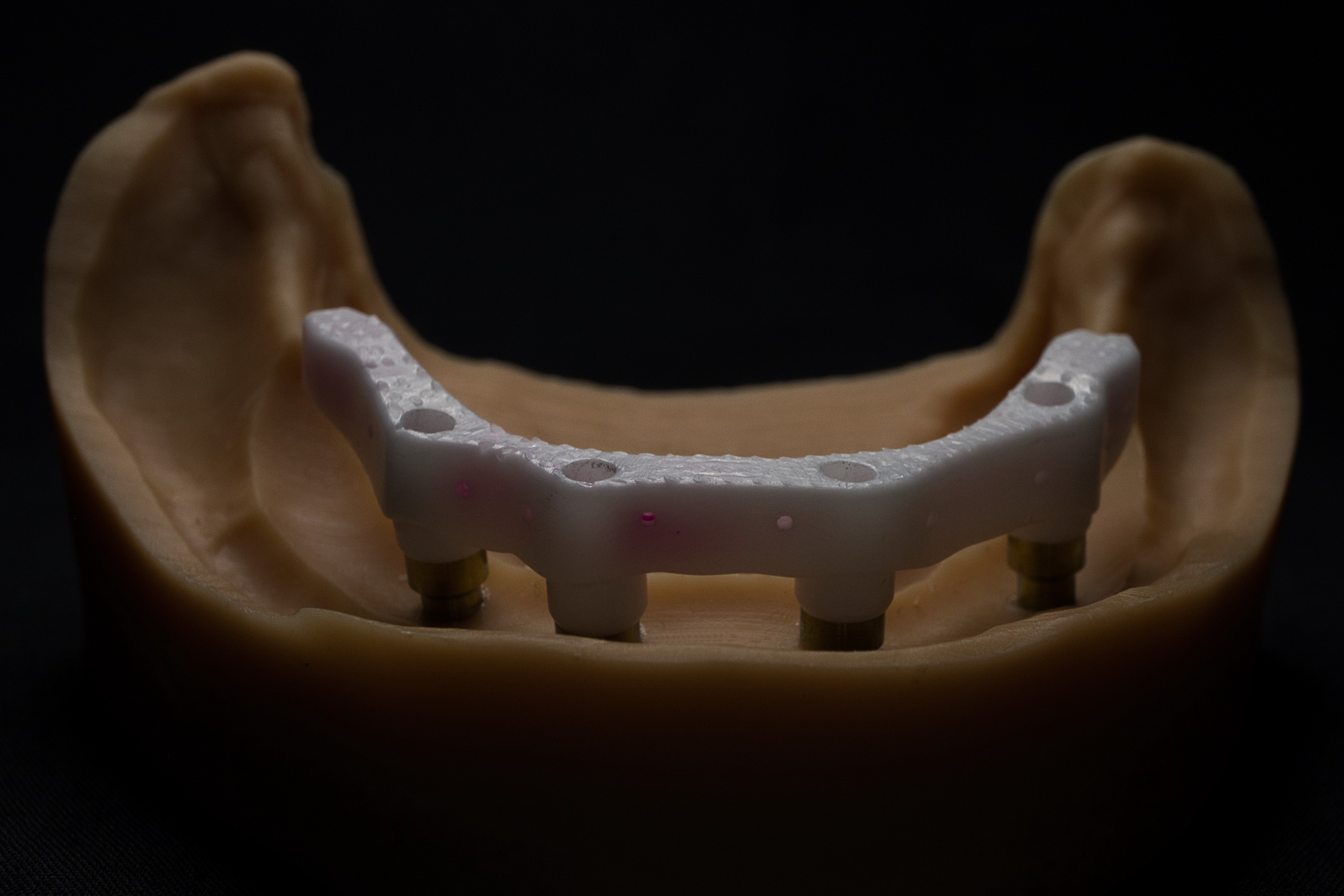 Fig. 22: 3D-printed zirconia implant bar.