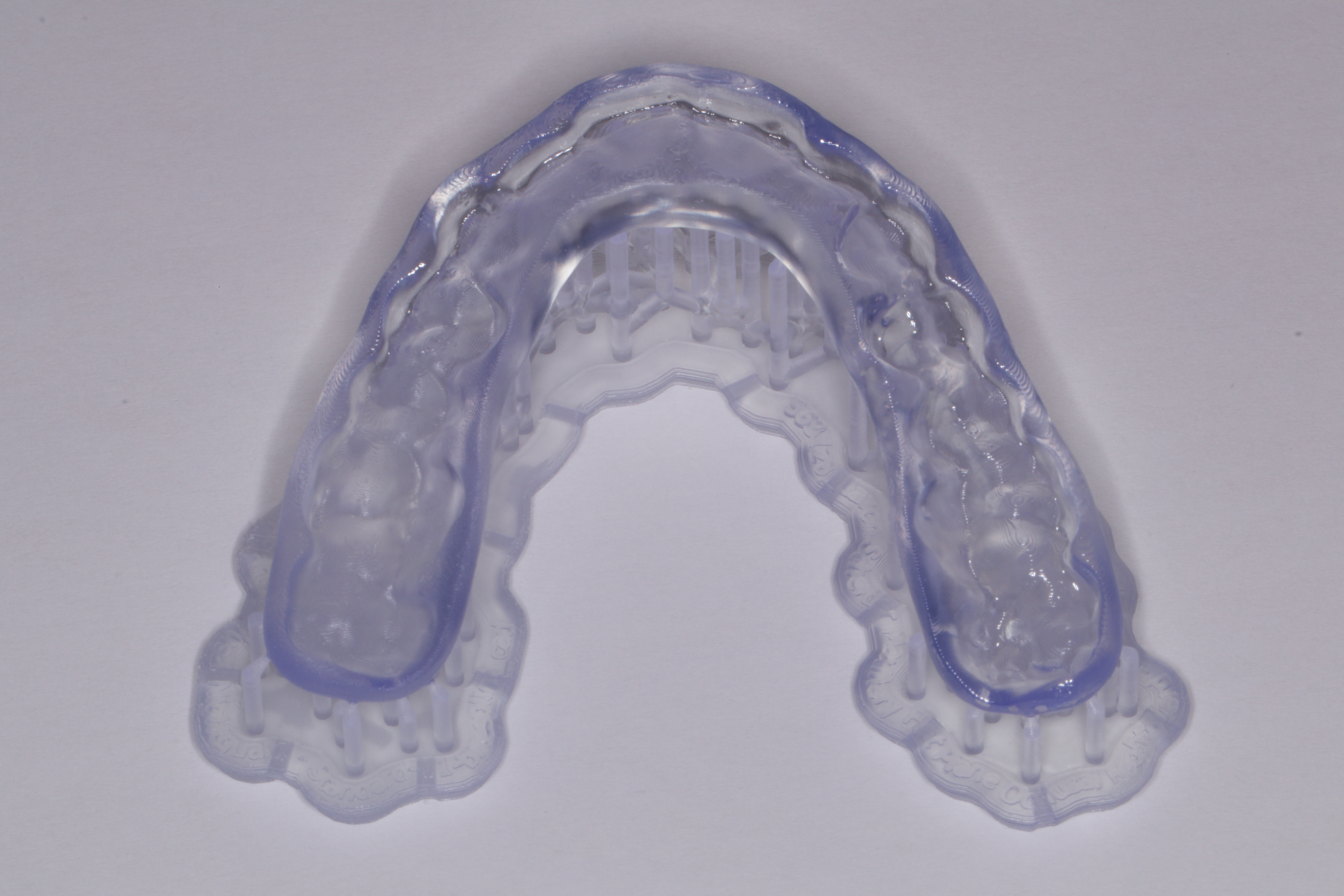 Fig. 7: Printed occlusal splint still on the supporting structures after polymerisation.