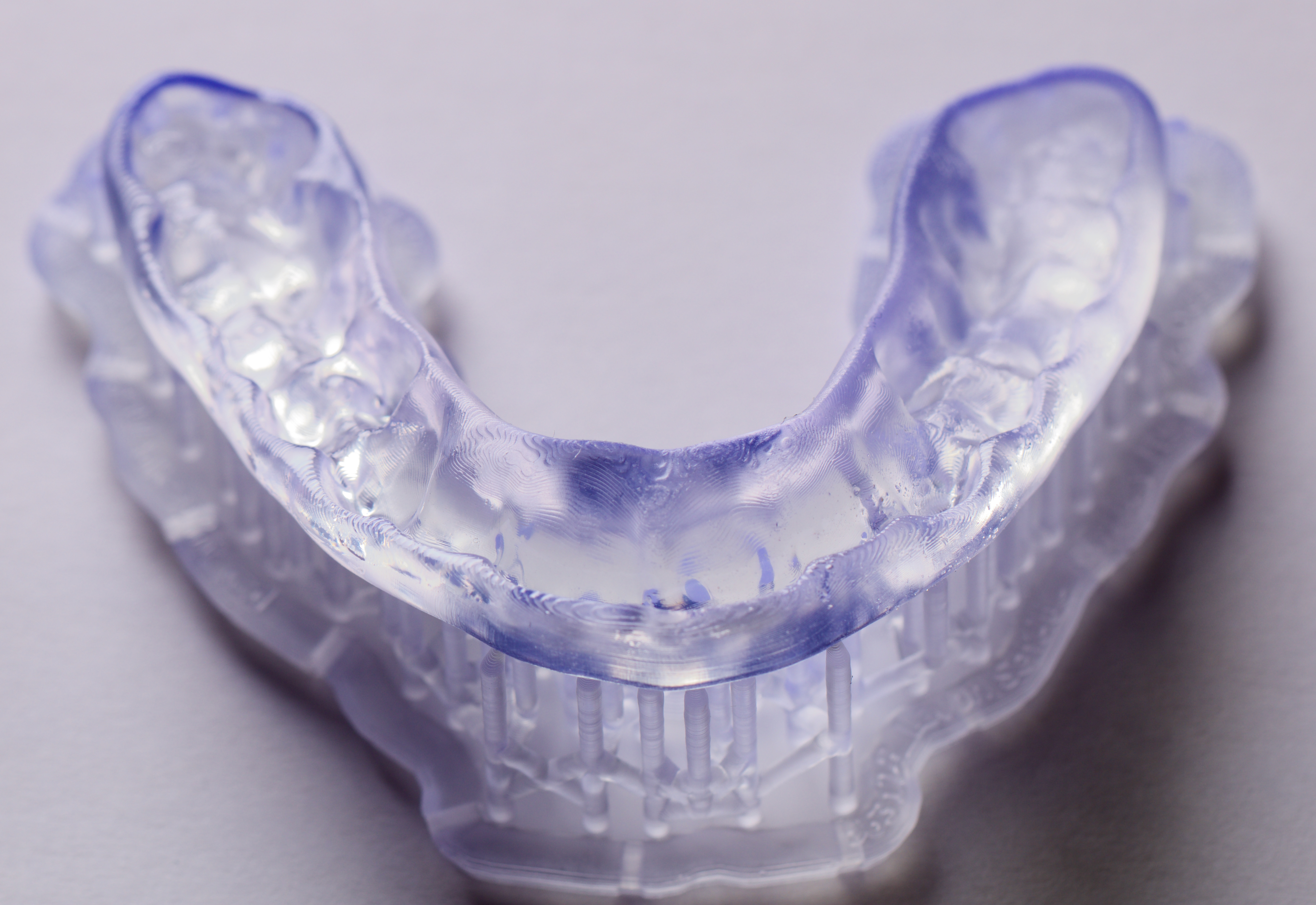 Fig. 8: Printed occlusal splint still on the supporting structures after polymerisation.
