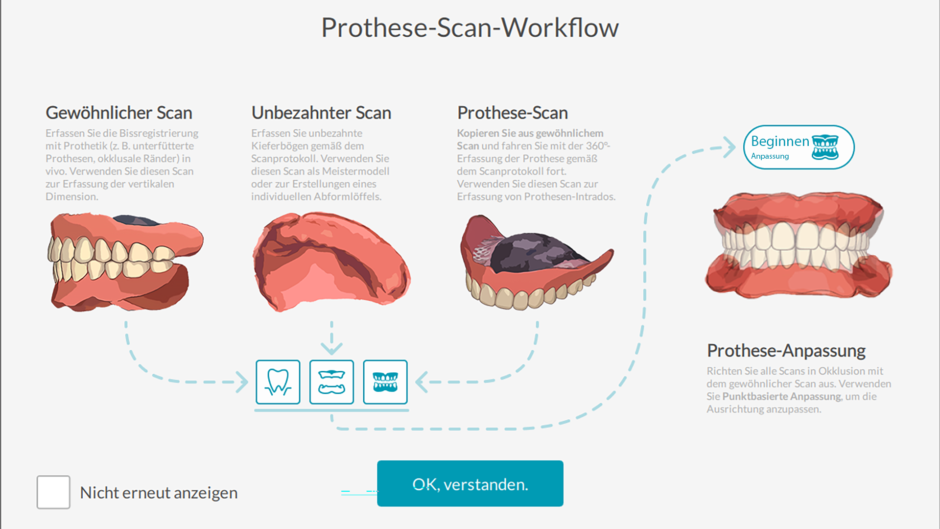 Schnell-Einführung in den Workflow für das Scannen von Prothesen. © DEXIS