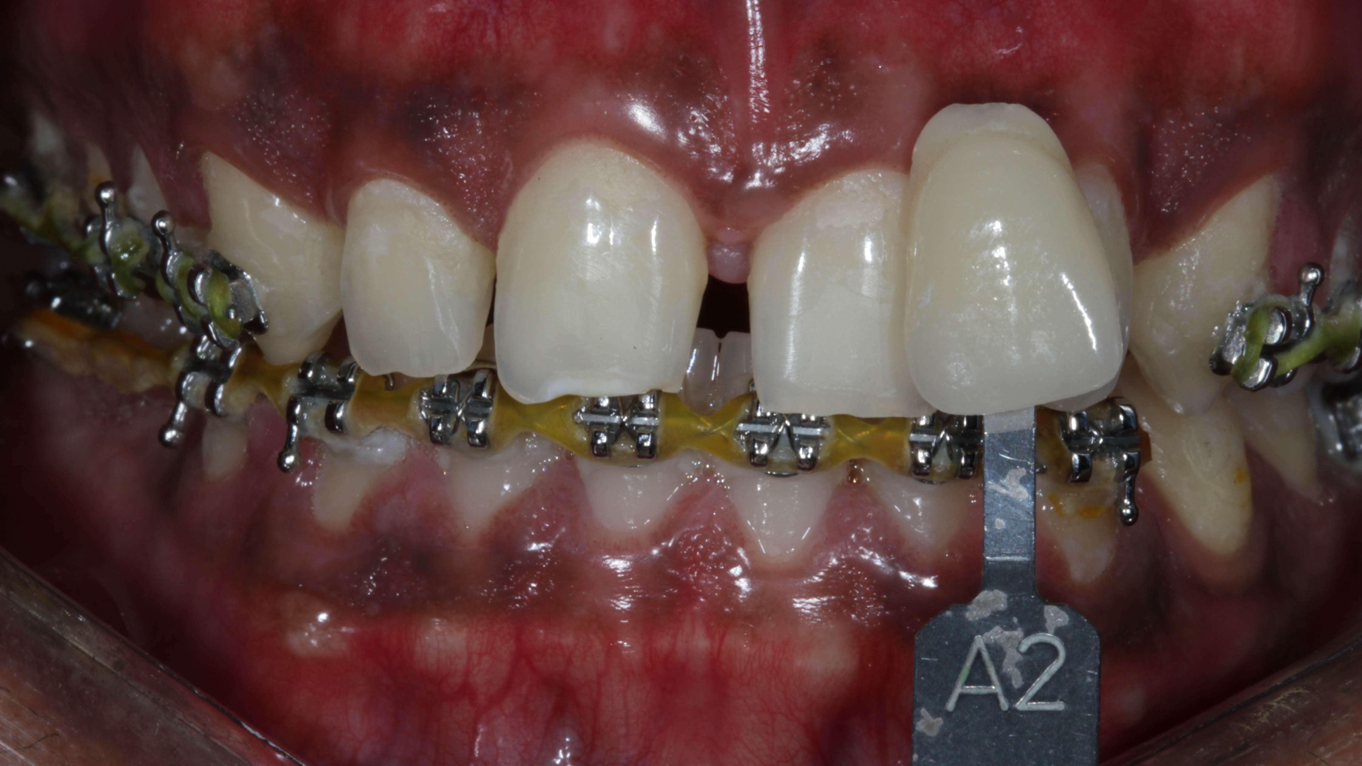 DT News - India - Ortho-Resto Continuum —An Interdisciplinary Approach ...