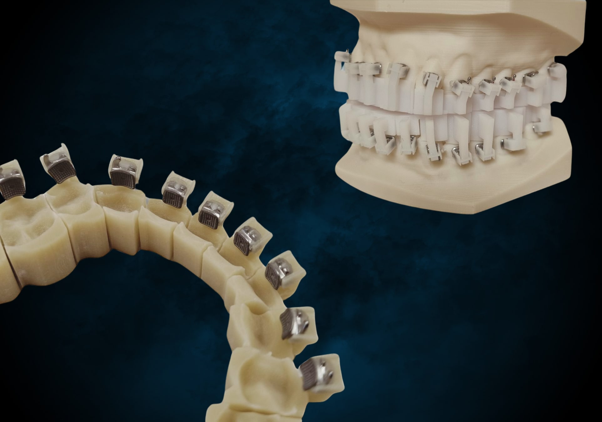 Polorto product Individually positioned appliance